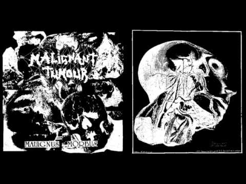 MALIGNANT TUMOUR / DECOMPOSED - Split 7" (1995)