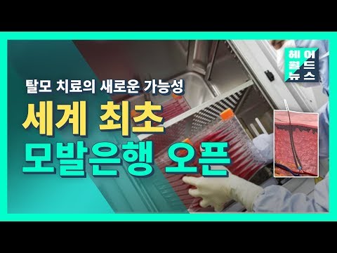 새로운 탈모치료법 공개! 헤어월드뉴스/ 세계최초 모발은행