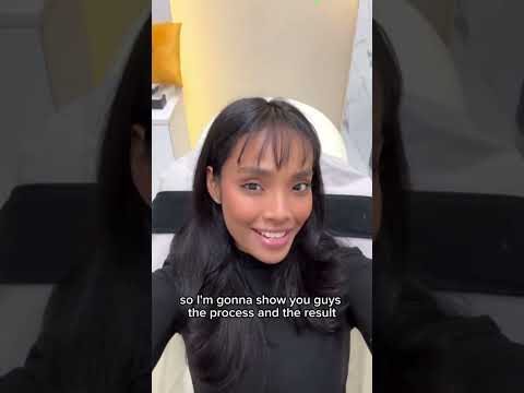 Sculptra with Haneesya: Pre-Aging Secrets for a Natural Glow at 25!