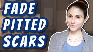 How to FADE PITTED SCARS | Dr Dray