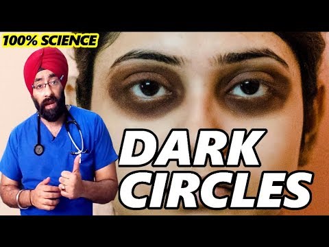 Permanently Cure DARK CIRCLES : आँखों के काले घेरे | Science + Home Remedy in HIndi | Dr.Education Video