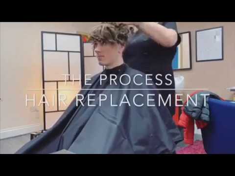 Hair Replacement: The Process