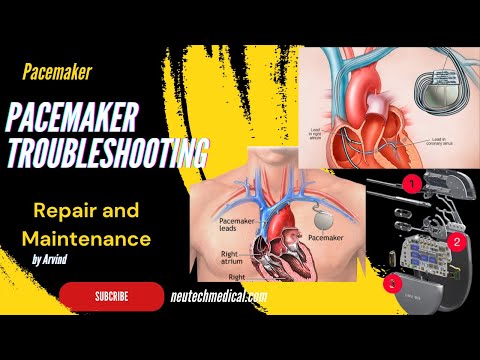 What is pacemaker how to work and Working Principle Advantage and Disadvantage