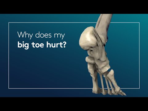 Why does my big toe hurt?
