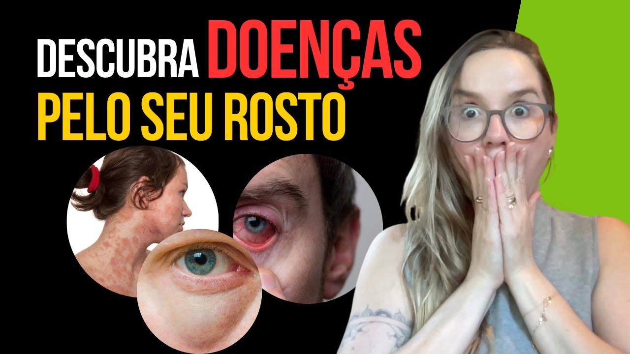 Seu Rosto Revela Tudo: 10 Problemas de Saúde ESCONDIDOS