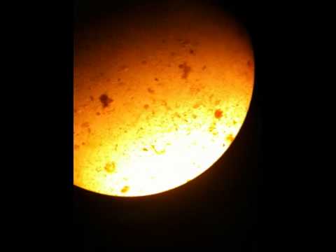 pourquoi les oxyures sortent la nuit