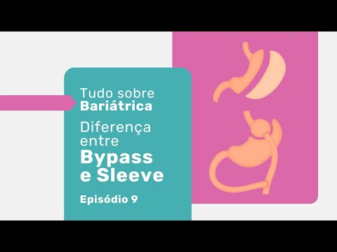 Bypass Gástrico: o que é, como funciona e o que muda na sua digestão 4 Bypass gástrico: vantagens e desvantagens — Dr. Rodrigo Barbosa