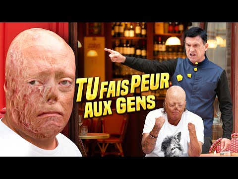 Se Moquer d’une Personne BRÛLÉE ( Expérience Sociale ) - AKHMETOV