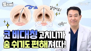 [무.물] 갸꿀~ 코 비대칭 고치니까 숨 쉬기도 편해져따｜1%성형외과  #김종구 #코수술 #코재수술