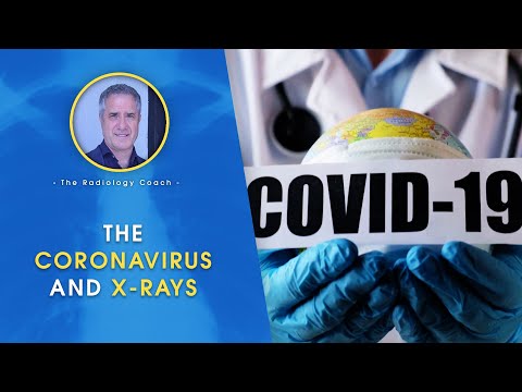 I felt a ZAP when getting x rays Is that possible