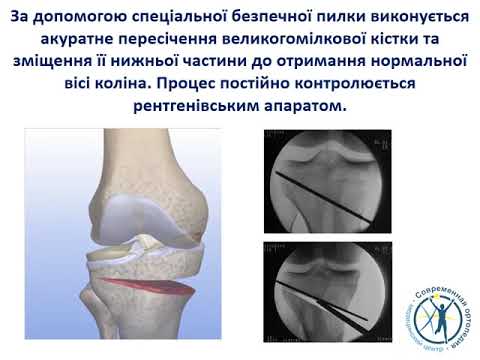Лекарство от грудного остеохондроза форум Боль в пояснице у женщин гимнастика