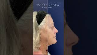 Ponte Vedra Plastic Surgery