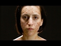 What Deadly Diseases Look Like On Your Body