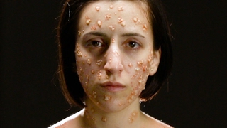 What Deadly Diseases Look Like On Your Body