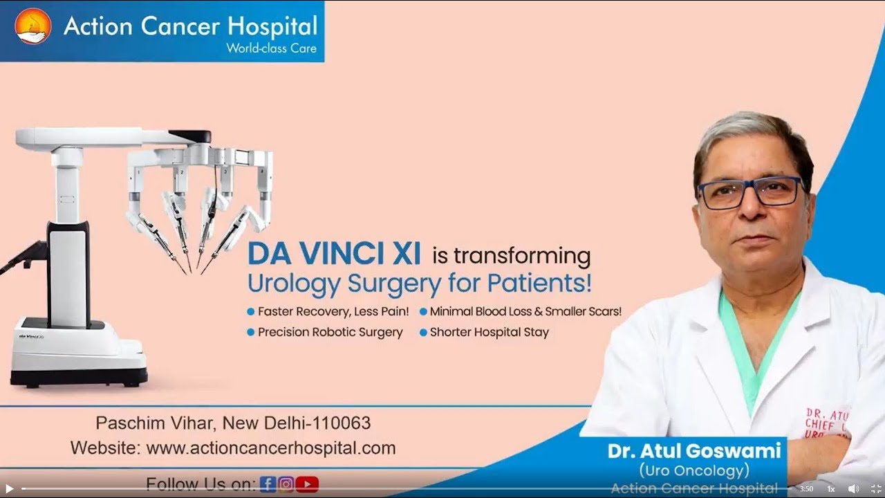 How the Da Vinci Xi Robot is Transforming Urology Surgery | Action Cancer Hospital