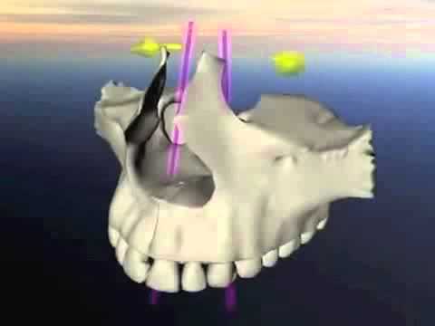 Dove andare con il bambino per la riabilitazione del bambino dopo lintervento chirurgico per le arti Rinforzare i med spinta della colonna vertebrale cervicale