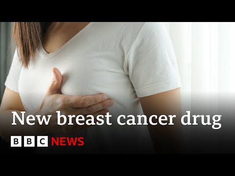 乳腺癌藥片給患者帶來 "四年的額外時間" | 英國廣播公司新聞 (Breast cancer pill gives patient 'four years of extra time’ | BBC News)