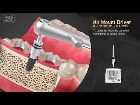 DENTIS DIGITAL GUIDE SYSTEM for SQ Implant, SQ GUIDE