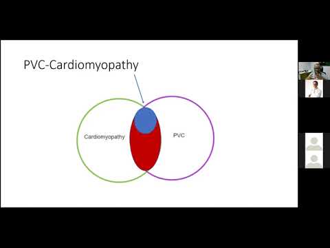 PVCs When Should We Worry