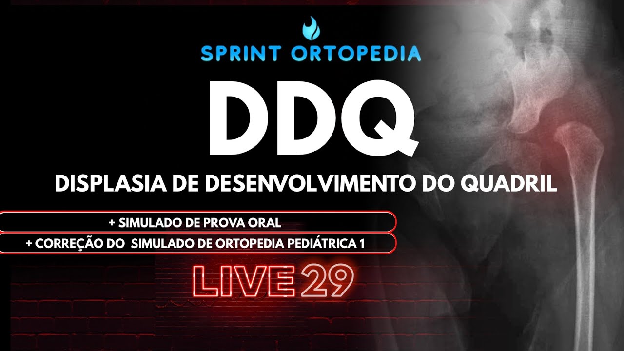 LIVE 29- DDQ- DISPLASIA DO DESENVOLVIMENTO DO QUADRIL