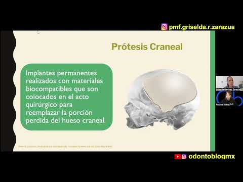 Prótesis Craneal