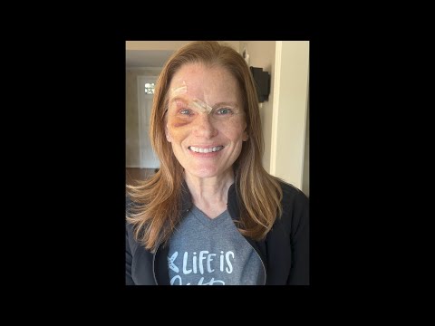 PHN After Shingles Led to Agonizing Facial Pain