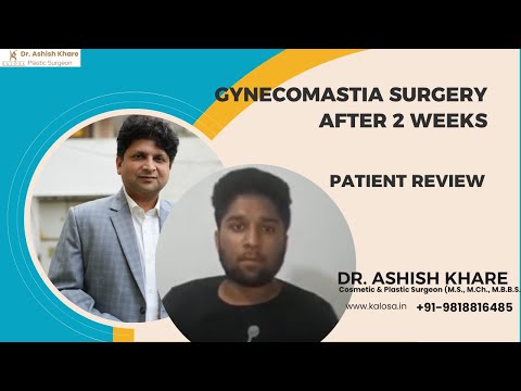Gynecomastia Result After 2 Weeks - REAL Patient Result| Male Breast Reduction Surgery in Gurgaon