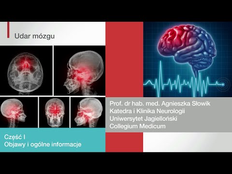 Udar mózgu, część 1: objawy i ogólne informacje