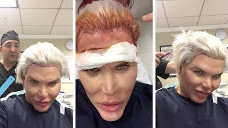 Human Ken Doll Gets Hair Transformation