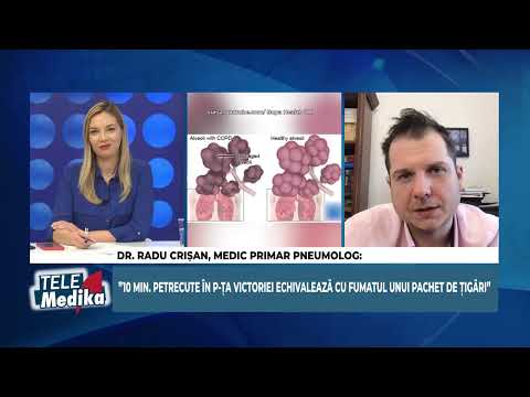 Telemedika 25.03.2021 - Cancerul pulmonar poate fi  însă vindecat și în stadii avansate