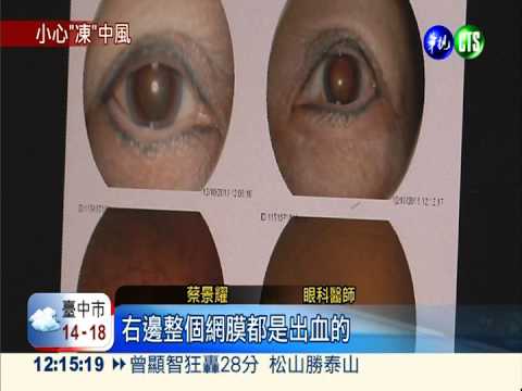 寒流眼中風暴增 嚴重恐變腦中風