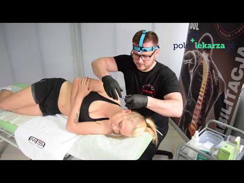 Poradnik fizjoterapeuty - Akupunktura przy bólach menstruacyjnych