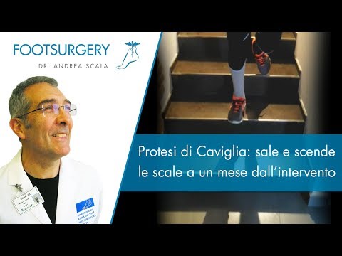 IRR in osteocondrosi della colonna cervicale Molteplici articolazioni sclerosi