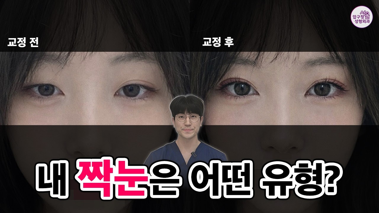 영상 썸네일