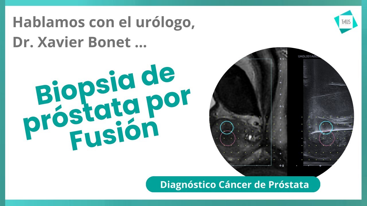 Xavier Bonet Puntí-31