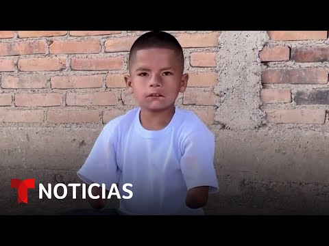 Un niño mexicano pide ayuda para conseguir sus prótesis de brazos | Noticias Telemundo