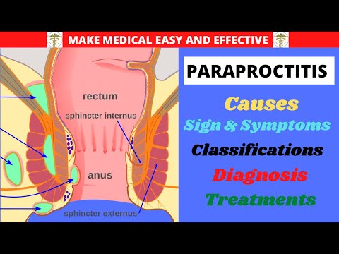 PARAPROCTITIS, CAUSES, CLASSIFICATIONS, SYMPTOMS, COMPLICATION, DIAGNOSIS, TREATMENTS