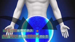 전립선암의 방사선 치료