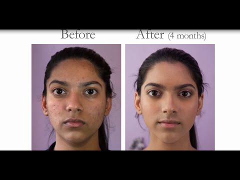 Bioderma Sebium Hydra Moisturising Compensating Creme Drėkinamasis kremas veidui, 40 ml video
