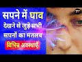 Sapne Me Ghav Dekhna Seeing Wounds In Dream Ghav Ka Sapna Dekhna Kaisa Hota Hai
