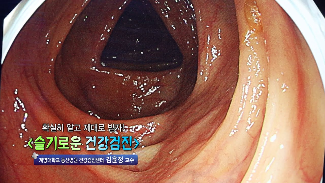 슬기로운 건강검진 | 건강증진센터 김윤정 교수 관련사진