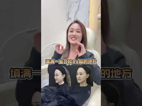 "People noticed I look younger, but didn't know why!" | Real Sculptra® Patient Feedback