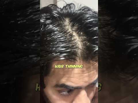 Best hair care routine for men | Hair fall | Hair loss