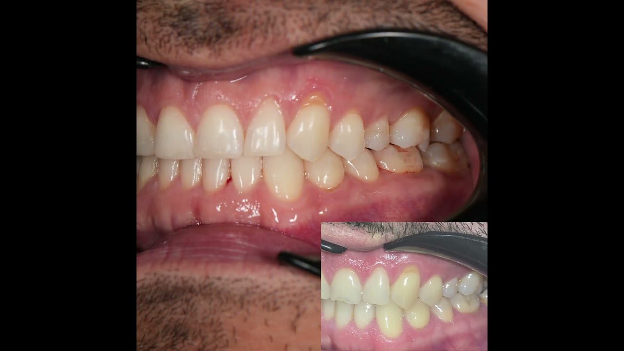 José Luis Mercadante Gutiérrez-107