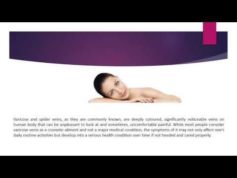 Things About Varicose and Spider Veins