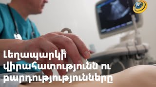 Արդյո՞ք լեղապարկի վիրահատությունից հետո առաջանում են լյարդի խնդիրներ