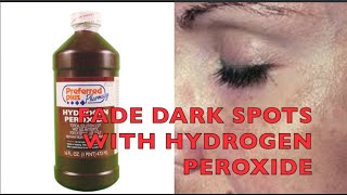 HYDROGEN PEROXIDE for FADING Brown Spots, Acne Scars, Sun Damage...