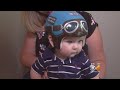 Baby Wears 'Aviator' Helmet For Protection After Skull Surgery