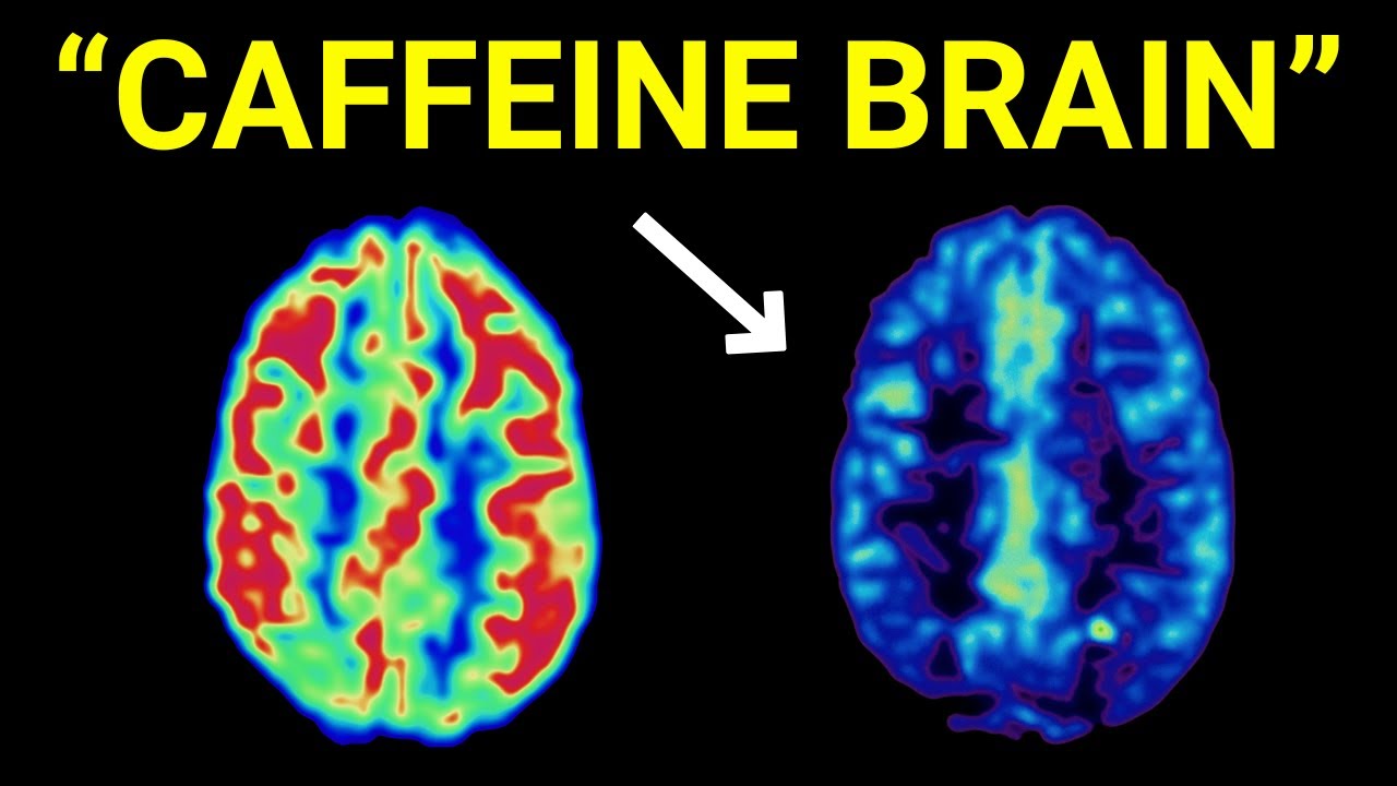 Why Coffee Might Be Destroying Your Brain