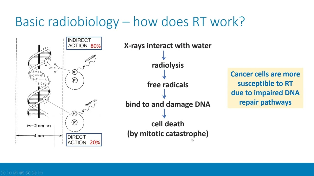 Dr. Brandon Imber: Modern Radiotherapy Techniques for the Treatment of Cancer